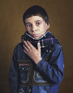 gueules cassées d'Irak