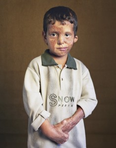 gueules cassées d'Irak