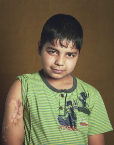 gueules cassées d'Irak