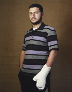 gueules cassées d'Irak