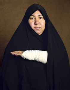 gueules cassées d'Irak