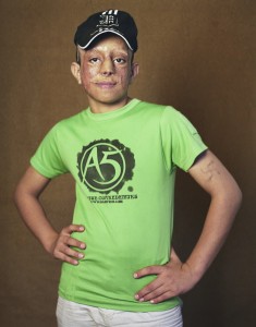 gueules cassées d'Irak