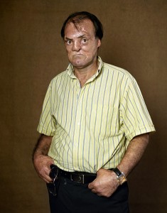 gueules cassées d'Irak