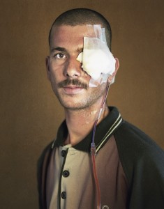 gueules cassées d'Irak