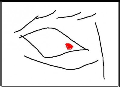 oeil