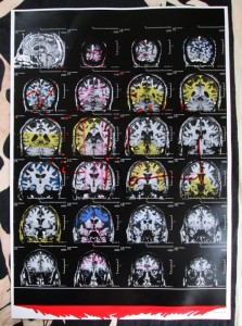 Cerveau-de-Renaud